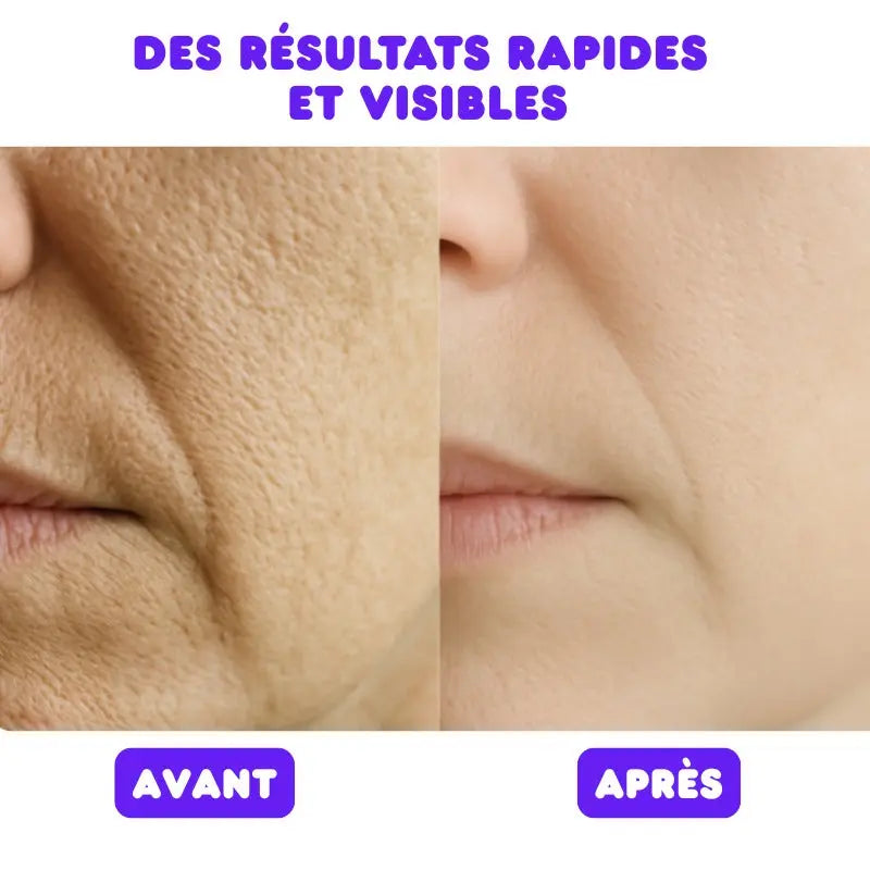 Masque LED Visage et Cou Thérapie Professionnelle Anti-âge Bounéo